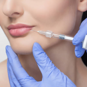 Hijaluronski dermalni fileri najnovije generacije